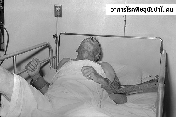 อาการโรคพิษสุนัขบ้าในคน