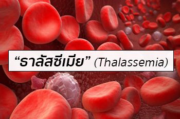 โรคธาลัสซีเมีย