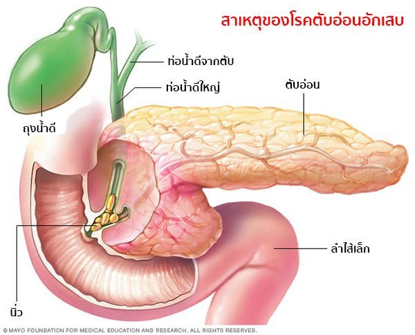 สาเหตุตับอ่อนอักเสบเกิดจากอะไร