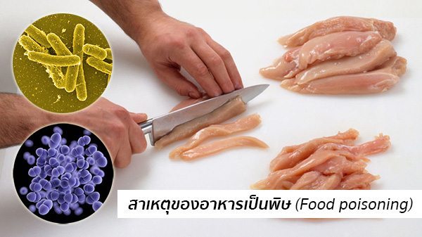 สาเหตุอาหารเป็นพิษ