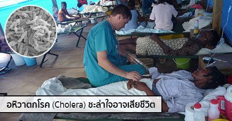 อหิวาตกโรค (Cholera) อาการ สาเหตุ การรักษาโรคอหิวาตกโรค 3 วิธี !!