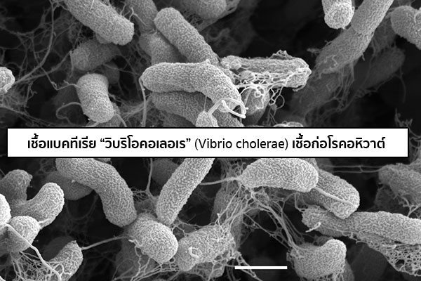vibrio cholerae คือ