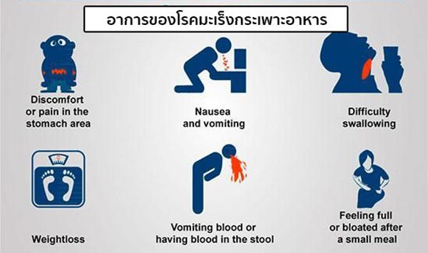 มะเร็งกระเพาะอาหารอาการ