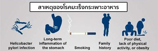 สาเหตุมะเร็งกระเพาะอาหาร