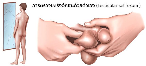 การตรวจมะเร็งอัณฑะด้วยตัวเอง