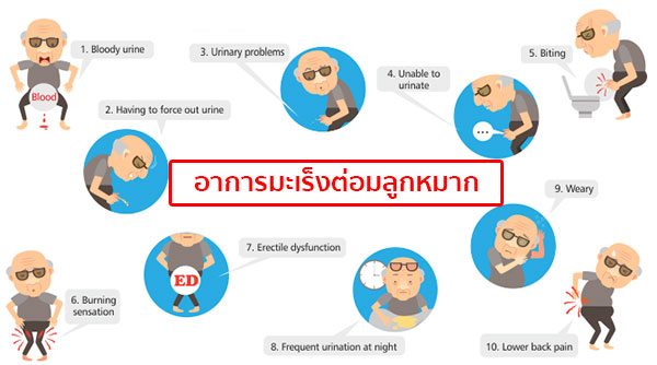 อาการมะเร็งต่อมลูกหมาก