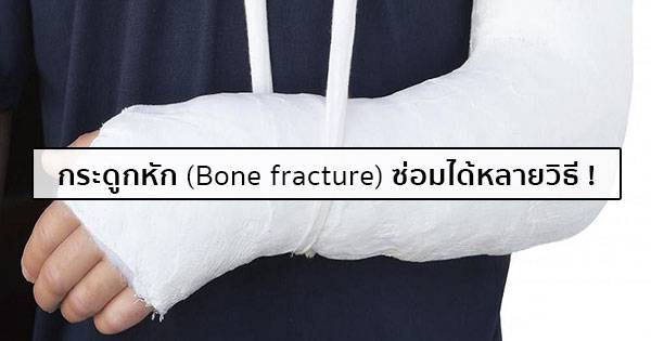 กระดูกหัก (Bone fracture) การปฐมพยาบาล & การรักษากระดูกหัก 5 วิธี !
