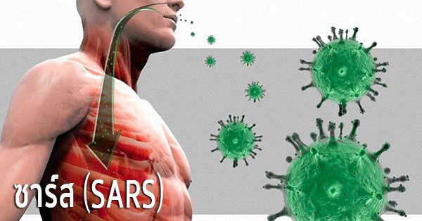 ซาร์ส (SARS) อาการ สาเหตุ และการรักษาโรคซาร์ส 5 วิธี !