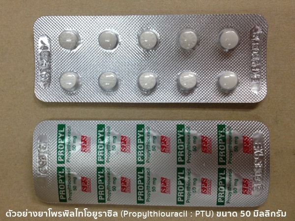 ยารักษาไทรอยด์เป็นพิษ
