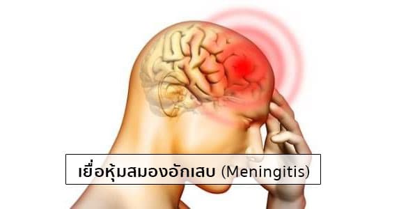 เยื่อหุ้มสมองอักเสบ (Meningitis) อาการ, สาเหตุ, การรักษา ฯลฯ