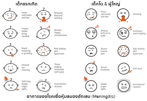 อาการเยื่อหุ้มสมองอักเสบ