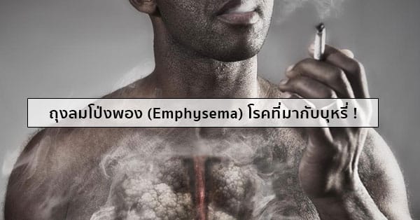 ถุงลมโป่งพอง (Emphysema) อาการ, สาเหตุ, การรักษา ฯลฯ