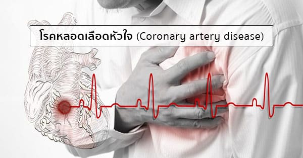 โรคหลอดเลือดหัวใจ (Coronary artery disease) อาการ สาเหตุ การรักษา ฯลฯ