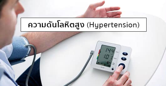 ความดันโลหิตสูง (Hypertension) อาการ, สาเหตุ, การรักษา, วิธีป้องกัน ฯลฯ