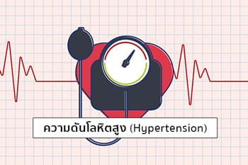 ความดันโลหิตสูง
