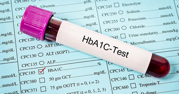 การตรวจค่าน้ำตาลสะสมในเลือด (Hemoglobin A1c : HbA1c)