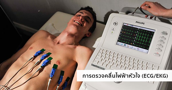 การตรวจคลื่นไฟฟ้าหัวใจ (Electrocardiogram : ECG หรือ EKG)