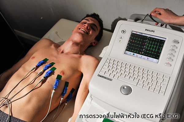 EKGคืออะไร