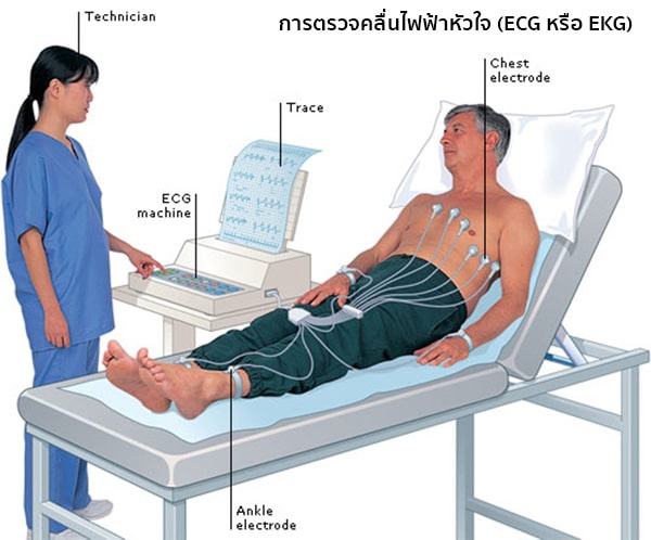 การตรวจคลื่นไฟฟ้าหัวใจ