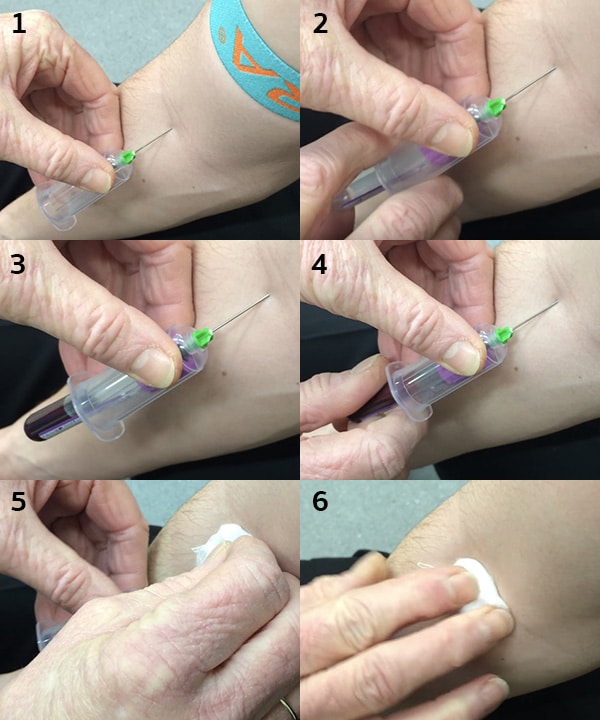 ขั้นตอนการตรวจHbA1c