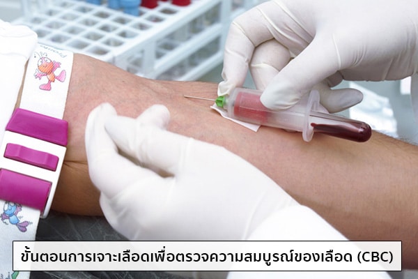 ขั้นตอนการตรวจความสมบูรณ์ของเลือด