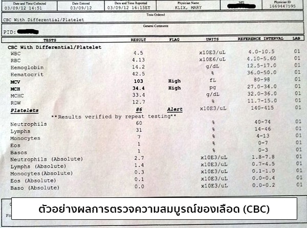 ตัวอย่างผลการตรวจความสมบูรณ์ของเลือด