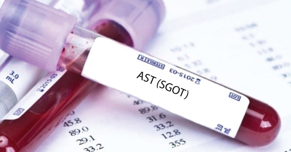 การตรวจ AST (SGOT) : Aspartate aminotransferase คืออะไร ?
