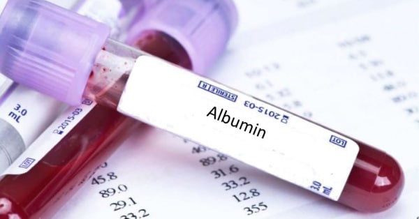 การตรวจ Albumin (อัลบูมิน) ในเลือด คืออะไร ?