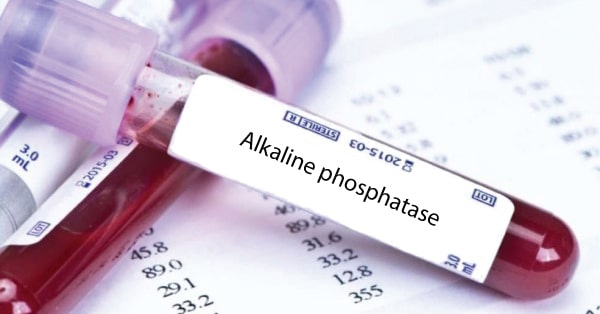 การตรวจ ALP (Alkaline phosphatase) คืออะไร ?