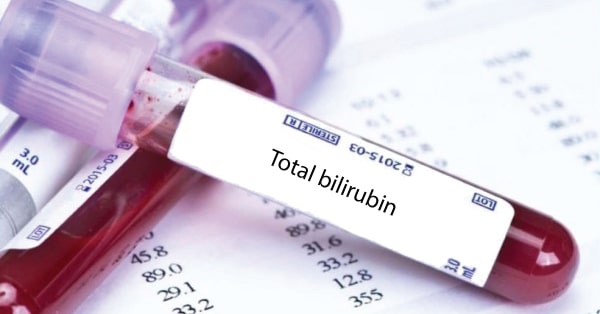 การตรวจ Total bilirubin (ค่าบิลิรูบินทั้งหมด) คืออะไร ?