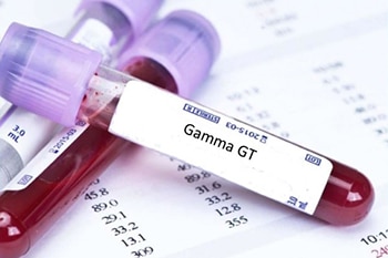 การตรวจ Gamma GT