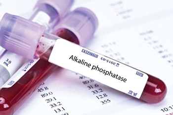 การตรวจ Alkaline phosphatase