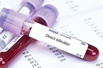 การตรวจ Direct bilirubin