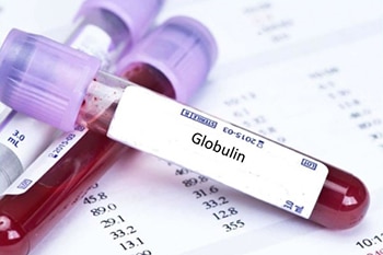 การตรวจ Globulin