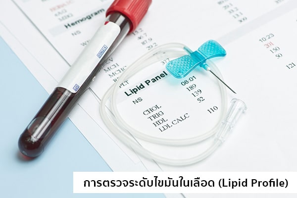 ตรวจไขมันในเลือด