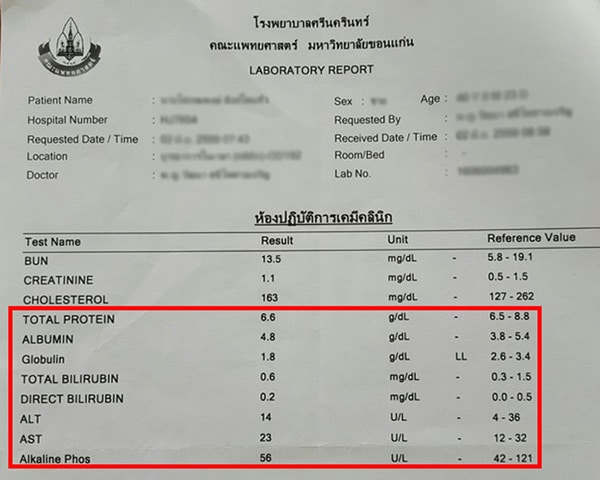 ผลการตรวจการทำงานของตับ