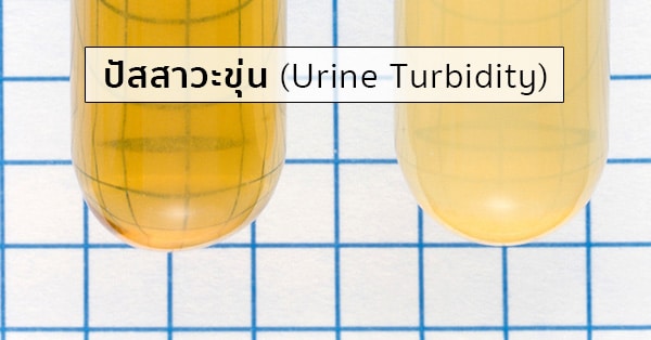 ปัสสาวะขุ่น (Urine Turbidity) อาการ สาเหตุ การรักษา ฯลฯ