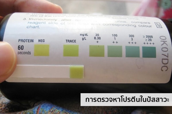 การตรวจหาโปรตีนในปัสสาวะ