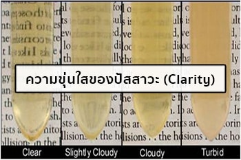 ความใสขุ่นของปัสสาวะ