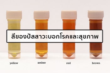 สีปัสสาวะ
