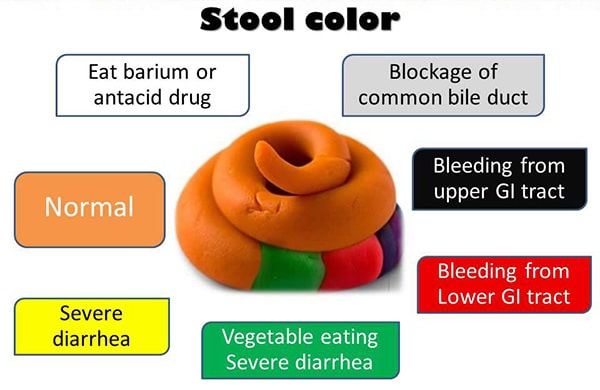 สีของอุจจาระ