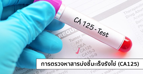 การตรวจหาสารบ่งชี้มะเร็งรังไข่ (CA125 : Cancer Antigen 125)