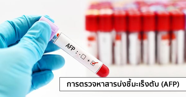 การตรวจหาสารบ่งชี้มะเร็งตับ (AFP : Alpha-Fetoprotien)