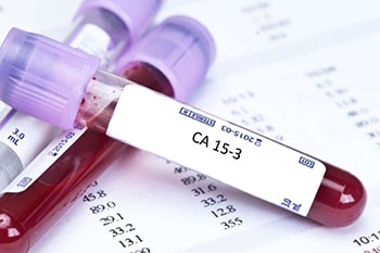 การตรวจ CA 15-3
