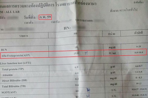 ผลการตรวจหาสารบ่งชี้มะเร็งตับ