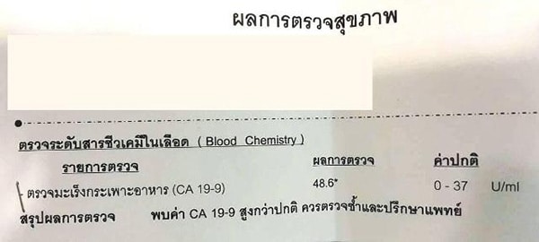ผลตรวจ CA 19-9