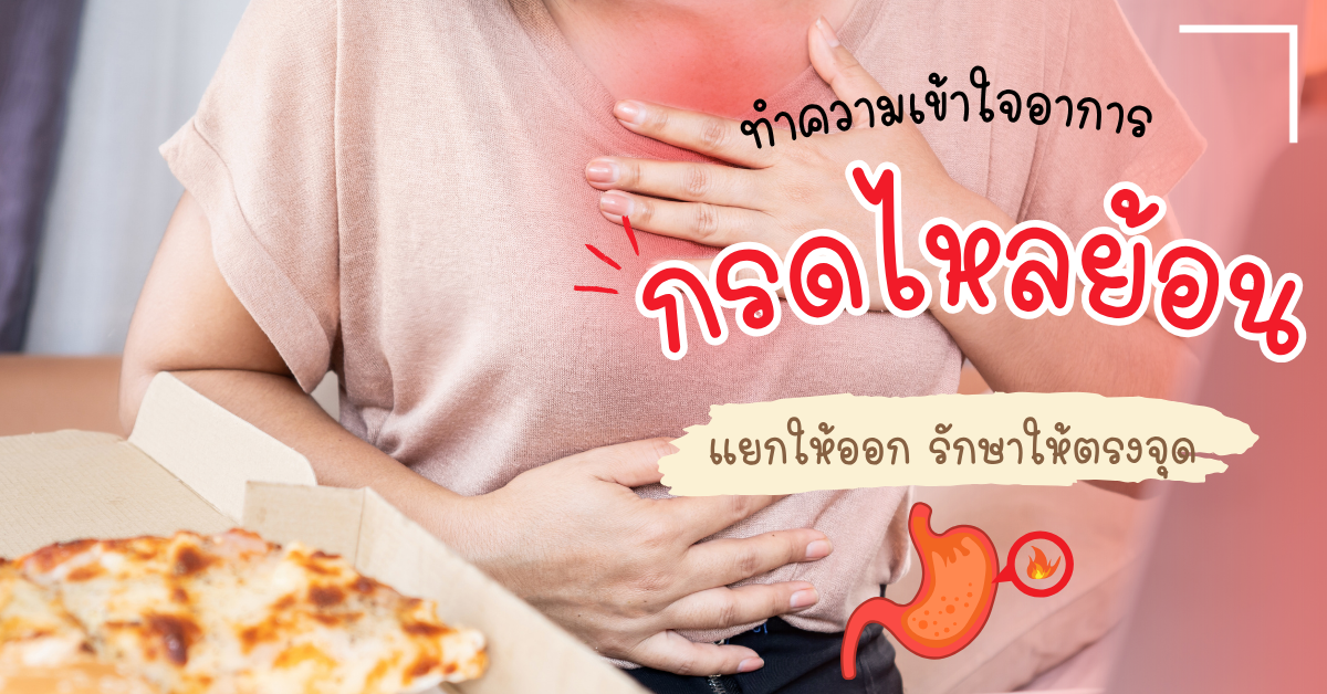 การรักษาโรคกรดไหลย้อน