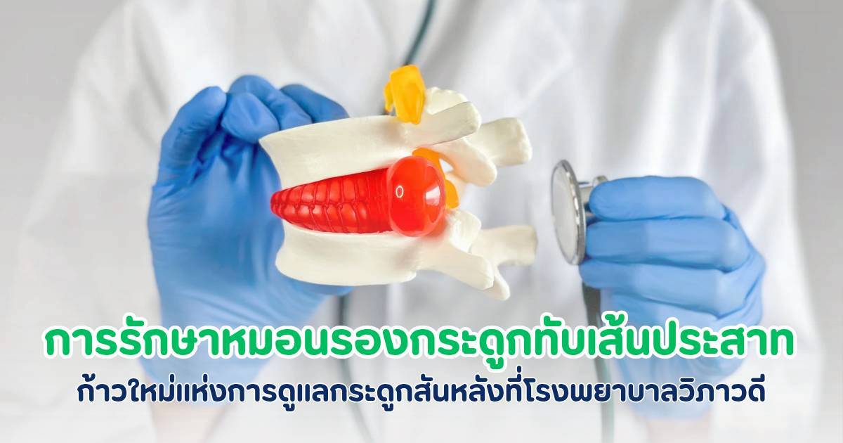 รักษาหมอนรองกระดูกทับเส้นประสาท ที่โรงพยาบาลวิภาวดี