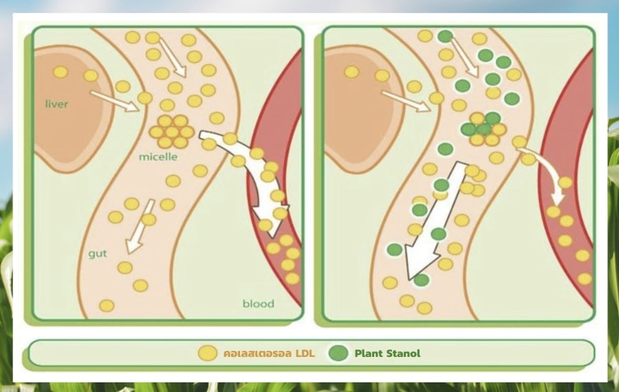 Plant Stanol มีกลไกช่วยลดการดูดซึมคอเลสเตอรอลเข้าสู่ร่างกาย